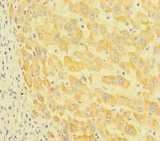 P3H2 / LEPREL1 Antibody - Immunohistochemistry of paraffin-embedded human liver tissue at dilution of 1:100