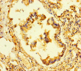 P3H2 / LEPREL1 Antibody - Immunohistochemistry of paraffin-embedded human lung tissue at dilution of 1:100