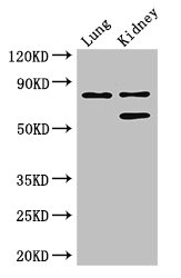 P3H2 / LEPREL1 Antibody - Western Blot Positive WB detected in:Mouse lung tissue,Mouse kidney tissue All Lanes: LEPREL1 antibody at 3ug/ml Secondary Goat polyclonal to rabbit IgG at 1/50000 dilution Predicted band size: 81,61 kDa Observed band size: 81,61 kDa