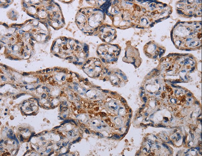 P3H3 / LEPREL2 Antibody - Immunohistochemistry of paraffin-embedded Human placenta using LEPREL2 Polyclonal Antibody at dilution of 1:50.