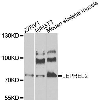P3H3 / LEPREL2 Antibody - Western blot analysis of extracts of various cells.