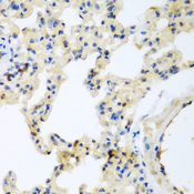 P3H3 / LEPREL2 Antibody - Immunohistochemistry of paraffin-embedded rat lung tissue.
