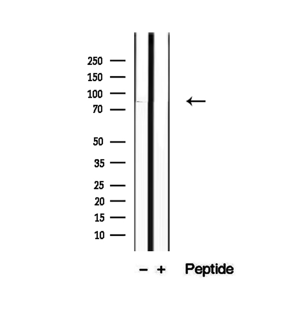P3H3 / LEPREL2 Antibody - Western blot analysis of extracts of human liver tissue using P3H3 antibody.