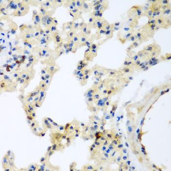 P3H3 / LEPREL2 Antibody - Immunohistochemistry of paraffin-embedded Rat lung using LEPREL2 Polyclonal Antibody at dilution of 1:200 (40x lens).