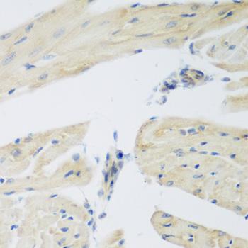 P3H3 / LEPREL2 Antibody - Immunohistochemistry of paraffin-embedded Mouse heart using LEPREL2 Polyclonal Antibody at dilution of 1:200 (40x lens).