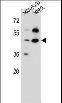 P3H4 / LEPREL4 Antibody - SC65 Antibody western blot of NCI-H292,K562 cell line lysates (35 ug/lane). The SC65 antibody detected the SC65 protein (arrow).