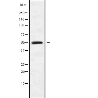 P3H4 / LEPREL4 Antibody - Western blot analysis SC65 using Jurkat whole cells lysates