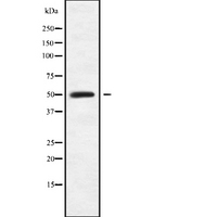 P3H4 / LEPREL4 Antibody - Western blot analysis SC65 using Jurkat whole cells lysates