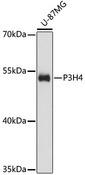 P3H4 / LEPREL4 Antibody - Western blot analysis of extracts of U-87MG cells using P3H4 Polyclonal Antibody at dilution of 1:3000.