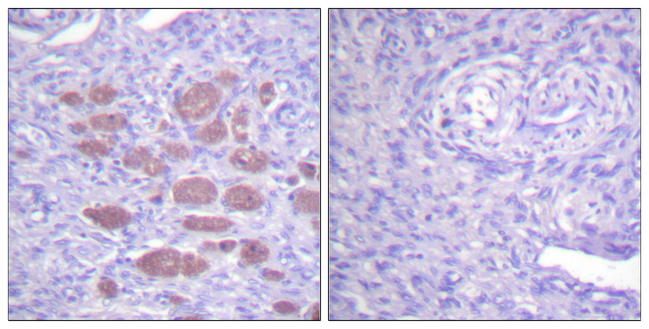 P40PHOX / NCF4 Antibody - Immunohistochemistry analysis of paraffin-embedded human ovary tissue, using p40 phox Antibody. The picture on the right is blocked with the synthesized peptide.
