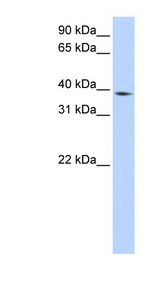 P40PHOX / NCF4 Antibody - NCF4 antibody Western blot of HepG2 cell lysate. This image was taken for the unconjugated form of this product. Other forms have not been tested.
