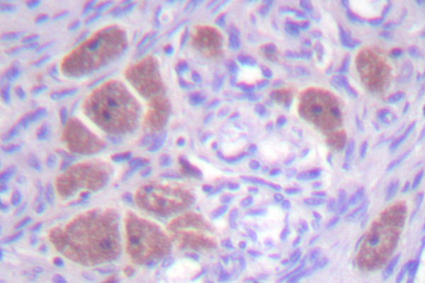 P40PHOX / NCF4 Antibody - IHC of p40 phox (R149) pAb in paraffin-embedded human ovary tissue.