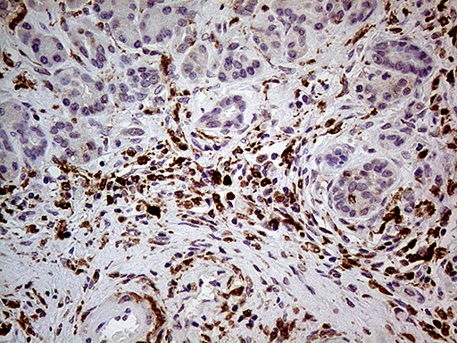 P40PHOX / NCF4 Antibody - Immunohistochemical staining of paraffin-embedded Human pancreas tissue within the normal limits using anti-NCF4 mouse monoclonal antibody. (Heat-induced epitope retrieval by 1mM EDTA in 10mM Tris buffer. (pH8.5) at 120°C for 3 min. (1:500)