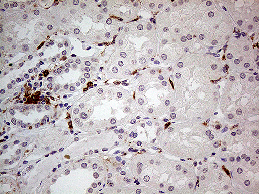 P40PHOX / NCF4 Antibody - Immunohistochemical staining of paraffin-embedded Human Kidney tissue within the normal limits using anti-NCF4 mouse monoclonal antibody. (Heat-induced epitope retrieval by 1mM EDTA in 10mM Tris buffer. (pH8.5) at 120°C for 3 min. (1:500)