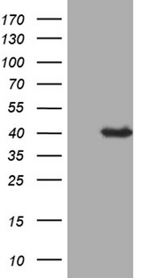P40PHOX / NCF4 Antibody - HEK293T cells were transfected with the pCMV6-ENTRY control. (Left lane) or pCMV6-ENTRY NCF4. (Right lane) cDNA for 48 hrs and lysed. Equivalent amounts of cell lysates. (5 ug per lane) were separated by SDS-PAGE and immunoblotted with anti-NCF4. (1:2000)