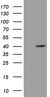 P40PHOX / NCF4 Antibody - HEK293T cells were transfected with the pCMV6-ENTRY control. (Left lane) or pCMV6-ENTRY NCF4. (Right lane) cDNA for 48 hrs and lysed. Equivalent amounts of cell lysates. (5 ug per lane) were separated by SDS-PAGE and immunoblotted with anti-NCF4. (1:500)