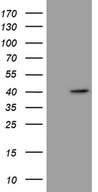 P40PHOX / NCF4 Antibody - HEK293T cells were transfected with the pCMV6-ENTRY control. (Left lane) or pCMV6-ENTRY NCF4. (Right lane) cDNA for 48 hrs and lysed. Equivalent amounts of cell lysates. (5 ug per lane) were separated by SDS-PAGE and immunoblotted with anti-NCF4. (1:500)