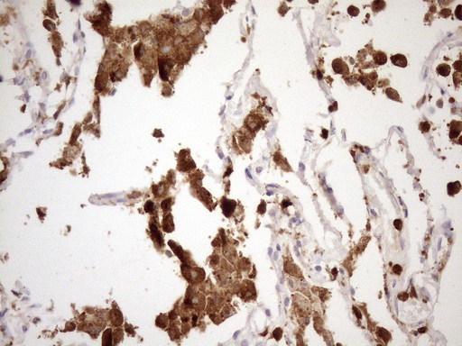 P40PHOX / NCF4 Antibody - Immunohistochemical staining of paraffin-embedded Human lung tissue within the normal limits using anti-NCF4 mouse monoclonal antibody. (Heat-induced epitope retrieval by 1mM EDTA in 10mM Tris buffer. (pH8.5) at 120°C for 3 min. (1:150)