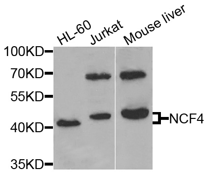 P40PHOX / NCF4 Antibody - Western blot analysis of extracts of various cells.