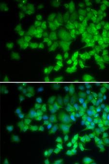 P40PHOX / NCF4 Antibody - Immunofluorescence analysis of U20S cells.