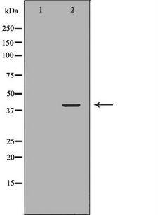 P40PHOX / NCF4 Antibody - Western blot analysis of extracts of K562 cells using NCF4 antibody. The lane on the left is treated with the antigen-specific peptide.