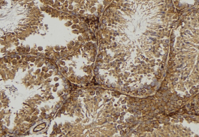 P40PHOX / NCF4 Antibody - 1:100 staining mouse testis tissue by IHC-P. The sample was formaldehyde fixed and a heat mediated antigen retrieval step in citrate buffer was performed. The sample was then blocked and incubated with the antibody for 1.5 hours at 22°C. An HRP conjugated goat anti-rabbit antibody was used as the secondary.
