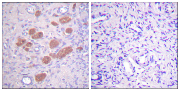 P40PHOX / NCF4 Antibody - Immunohistochemistry analysis of paraffin-embedded human ovary, using p40 phox (Phospho-Thr154) Antibody. The picture on the right is blocked with the phospho peptide.