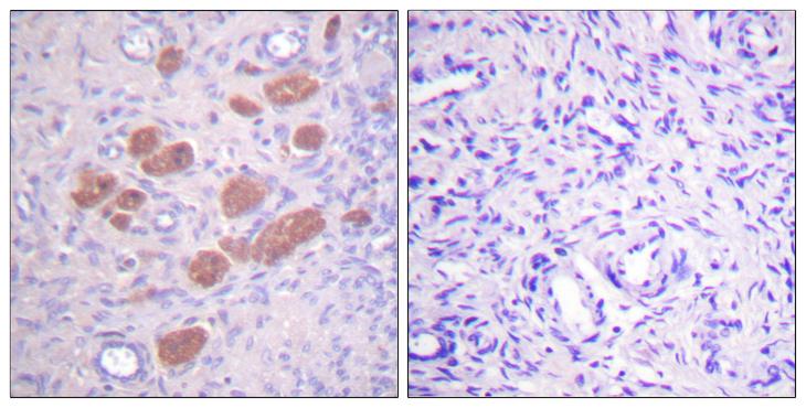 P40PHOX / NCF4 Antibody - P-peptide - + Immunohistochemistry analysis of paraffin-embedded human ovary tissue using p40 phox (Phospho-Thr154) antibody.