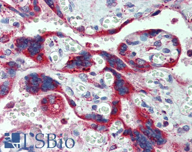 P450SCC / CYP11A1 Antibody - Anti-CYP11A1 antibody IHC of human placenta. Immunohistochemistry of formalin-fixed, paraffin-embedded tissue after heat-induced antigen retrieval. Antibody concentration 5 ug/ml.  This image was taken for the unconjugated form of this product. Other forms have not been tested.