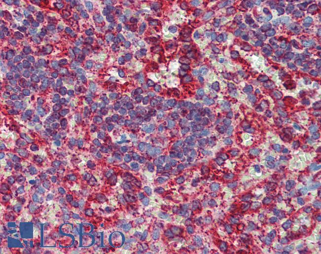 P450SCC / CYP11A1 Antibody - Anti-CYP11A1 antibody IHC of human spleen. Immunohistochemistry of formalin-fixed, paraffin-embedded tissue after heat-induced antigen retrieval. Antibody concentration 5 ug/ml.  This image was taken for the unconjugated form of this product. Other forms have not been tested.