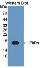 P450SCC / CYP11A1 Antibody - Western blot of P450SCC / CYP11A1 antibody.