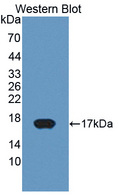 P450SCC / CYP11A1 Antibody - Western blot of P450SCC / CYP11A1 antibody.