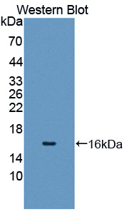 P450SCC / CYP11A1 Antibody - Western blot of P450SCC / CYP11A1 antibody.