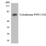 P450SCC / CYP11A1 Antibody - Western blot analysis of the lysates from HeLa cells using Cytochrome P450 11A1 antibody.
