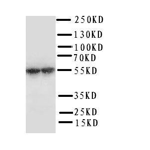 P450SCC / CYP11A1 Antibody - WB of P450SCC / CYP11A1 antibody. WB: Human Placenta Tissue Lysate.