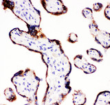 P450SCC / CYP11A1 Antibody - P450SCC / CYP11A1 antibody. IHC(P): Human Placenta Tissue.