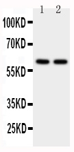 P450SCC / CYP11A1 Antibody - Anti-CYP11A1 antibody, Western blottingWB: Human Placenta Tissue Lysate