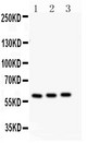 P450SCC / CYP11A1 Antibody - CYP11A1 antibody Western blot. All lanes: Anti CYP11A1 at 0.5 ug/ml. Lane 1: Rat Testis Tissue Lysate at 50 ug. Lane 2: Mouse Testis Tissue Lysate at 50 ug. Lane 3: Mouse Brain Tissue Lysate at 50 ug. Predicted band size: 60 kD. Observed band size: 60 kD.