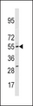 P450SCC / CYP11A1 Antibody - Western blot of anti-CYP11A1 Antibody in HepG2 cell line lysates (35 ug/lane). CYP11A1(arrow) was detected using the purified antibody.