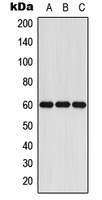 P450SCC / CYP11A1 Antibody - Western blot analysis of Cytochrome P450 11A1 expression in Jurkat (A); mouse liver (B); rat liver (C) whole cell lysates.