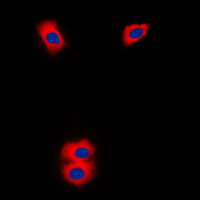 P450SCC / CYP11A1 Antibody - Immunofluorescent analysis of Cytochrome P450 11A1 staining in Jurkat cells. Formalin-fixed cells were permeabilized with 0.1% Triton X-100 in TBS for 5-10 minutes and blocked with 3% BSA-PBS for 30 minutes at room temperature. Cells were probed with the primary antibody in 3% BSA-PBS and incubated overnight at 4 C in a humidified chamber. Cells were washed with PBST and incubated with a DyLight 594-conjugated secondary antibody (red) in PBS at room temperature in the dark. DAPI was used to stain the cell nuclei (blue).