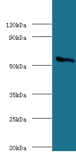 P450SCC / CYP11A1 Antibody - Western blot of Cholesterol side-chain cleavage enzyme, mitochondrial antibody at 2 ug/ml with rat adrenal gland secondary Goat polyclonal to rabbit at 1:10000 dilution predicted band size: 60 KDa observed band size: 60 KDa.  This image was taken for the unconjugated form of this product. Other forms have not been tested.