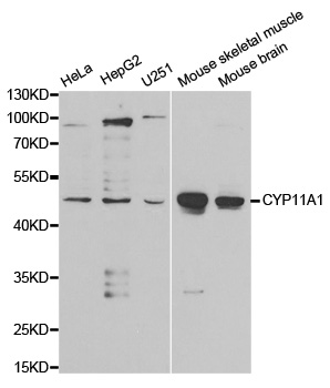 P450SCC / CYP11A1 Antibody - Western blot analysis of extracts of various cell lines.