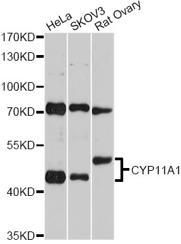 P450SCC / CYP11A1 Antibody - Western blot analysis of extracts of various cell lines, using CYP11A1 antibody at 1:2000 dilution. The secondary antibody used was an HRP Goat Anti-Rabbit IgG (H+L) at 1:10000 dilution. Lysates were loaded 25ug per lane and 3% nonfat dry milk in TBST was used for blocking. An ECL Kit was used for detection and the exposure time was 30s.