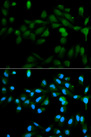 P450SCC / CYP11A1 Antibody - Immunofluorescence analysis of HeLa cells using CYP11A1 antibodyat dilution of 1:100 (40x lens). Blue: DAPI for nuclear staining.