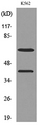 P450SCC / CYP11A1 Antibody - Western blot analysis of lysate from K562 cells, using CYP11A1 Antibody.