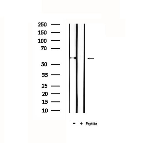 P450SCC / CYP11A1 Antibody - Western blot analysis of extracts of rat spleen using Cytochrome P450 11A1 antibody.