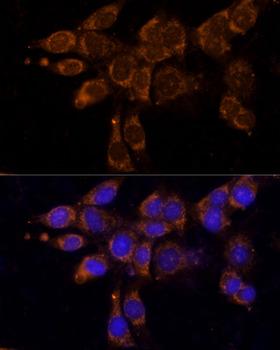 P450SCC / CYP11A1 Antibody - Immunofluorescence analysis of NIH/3T3 cells using CYP11A1 Polyclonal Antibody at dilution of 1:100.Blue: DAPI for nuclear staining.