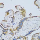 P450SCC / CYP11A1 Antibody - Immunohistochemistry of paraffin-embedded Human placenta using CYP11A1 Polyclonal Antibody at dilution of 1:150 (40x lens).
