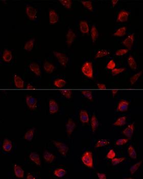 P450SCC / CYP11A1 Antibody - Immunofluorescence analysis of L929 cells using CYP11A1 Polyclonal Antibody at dilution of 1:100.Blue: DAPI for nuclear staining.